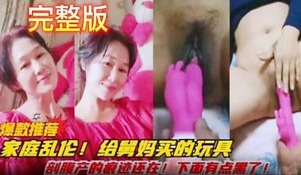 给舅妈买的玩具 剖腹产的痕迹还在 下面有点黑了 封面
