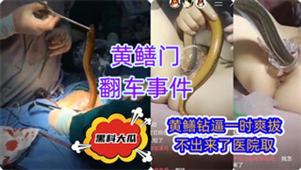黄鳝门翻车事件直播黄鳝插逼医院取 封面
