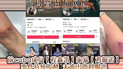 抖音百万网红 前cuba成员程鑫凯家暴鸡腿诺事件持续发酵 未流出资料曝光! 全集 封面